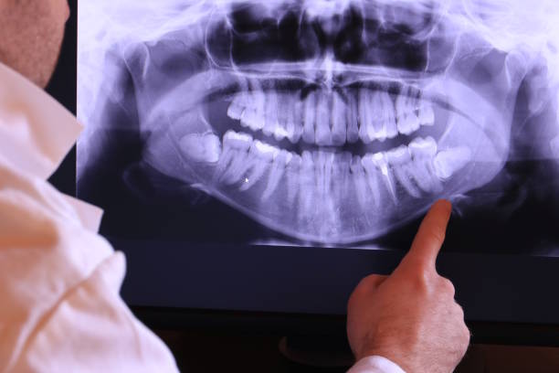  Georgetown, CT Emergency Dentist Pros